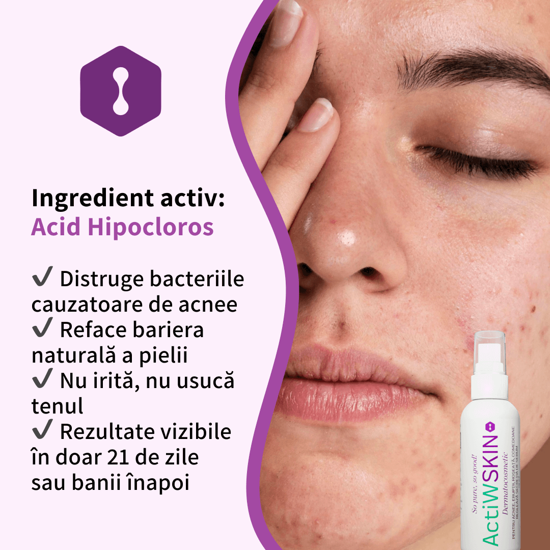 ActiW SKIN - PENTRU ACNEE - Pachet mic - Tratament 12-15 zile